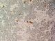 Duela pequeña del hígado<br />(Dicrocoelium dendriticum)