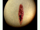 Duela pequeña del hígado<br />(Dicrocoelium dendriticum)