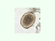 Lombriz intestinal grande<br />(Ascaris lumbricoides)