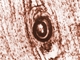 <i>Trichinella spiralis</i>