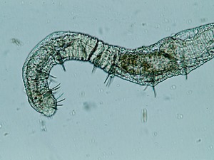 Chaetogaster diastrophus