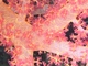 Árbol de navidad de Klunzinger<br />(Dendronephthya klunzingeri)