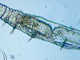 <i>Chaetogaster diastrophus</i>