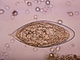 Huevo transparente con miracidia., por CDC Public Health Image Library