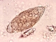 <i>Schistosoma haematobium</i>
