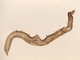 <i>Schistosoma mansoni</i>