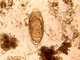 <i>Schistosoma mansoni</i>